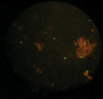 Imagen: Resultado de una prueba FDA, al microscopio: las líneas fluorescentes son bacilos tuberculosos vivos, sobre un fondo de detritos celulares de esputo humano (Fotografía cortesía del ITG).